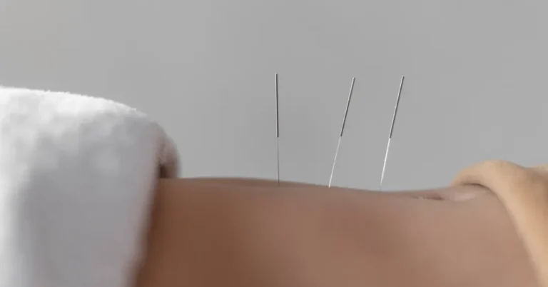 Nutricionistas Podem Aplicar Acupuntura para Controlar Fome? Entenda a Decisão e o Que Diz a Ciência